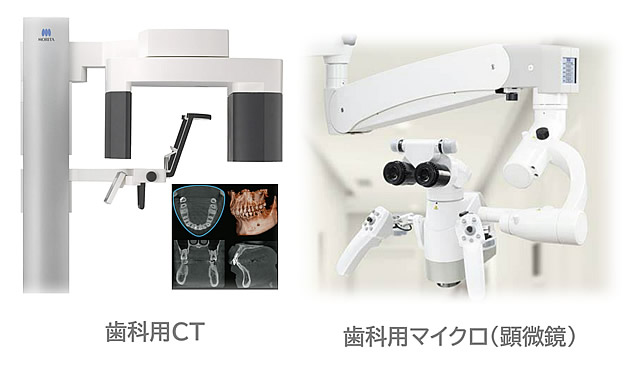 精密根管治療とは